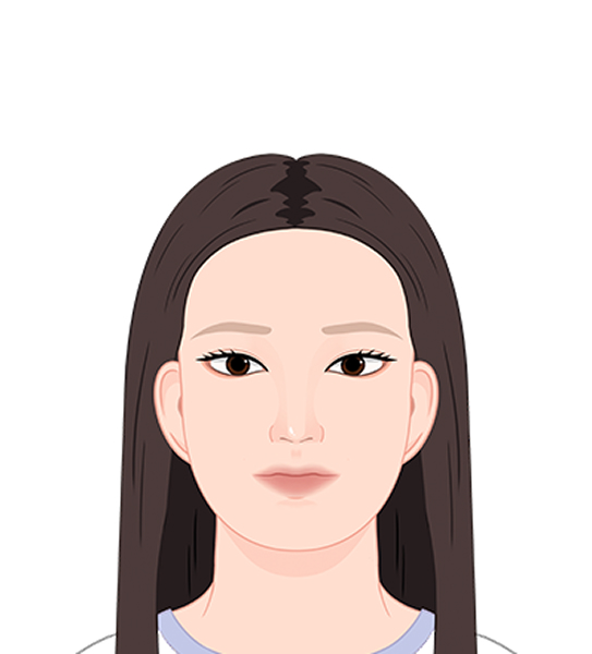 둥근형