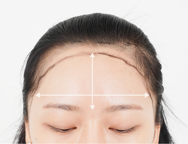 Wide forehead reduction effect