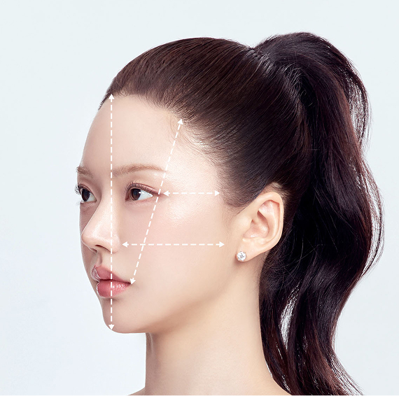 Side ratio