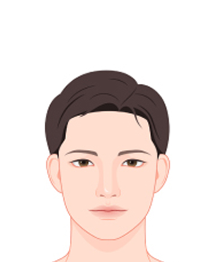 계란형